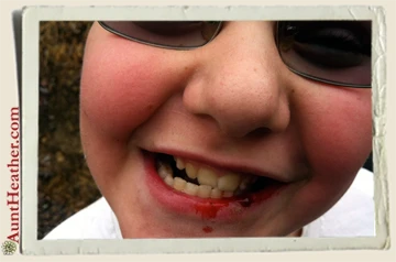 Kyle-Bloody-Lip-Aunt-Heather-Piper-2013
